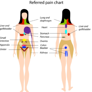 Referred-Pain-Patterns